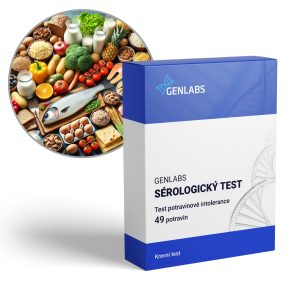 Test potravinové intolerance 49 potravin